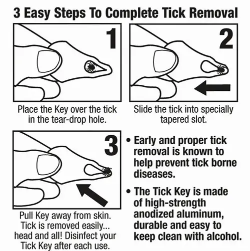 Tick Removal Instructions